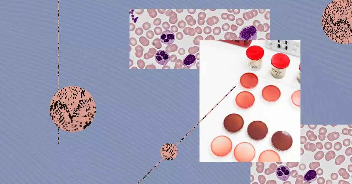 Understanding Multiple Myeloma: Types, Symptoms, and Related Disorders