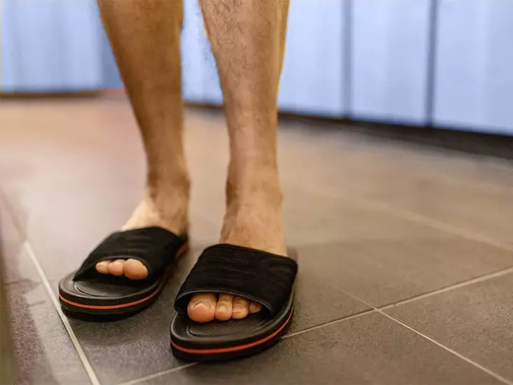 Confronting Diabetes: Understanding the Skin’s Silent Signals